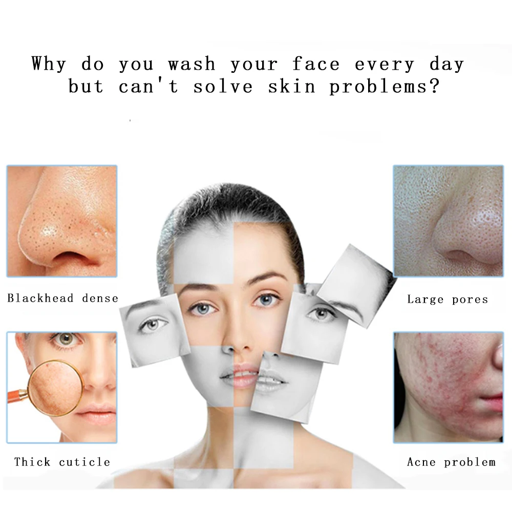 Маленькие пузырьки Красота устройство всасывания Черноголовых Удаления