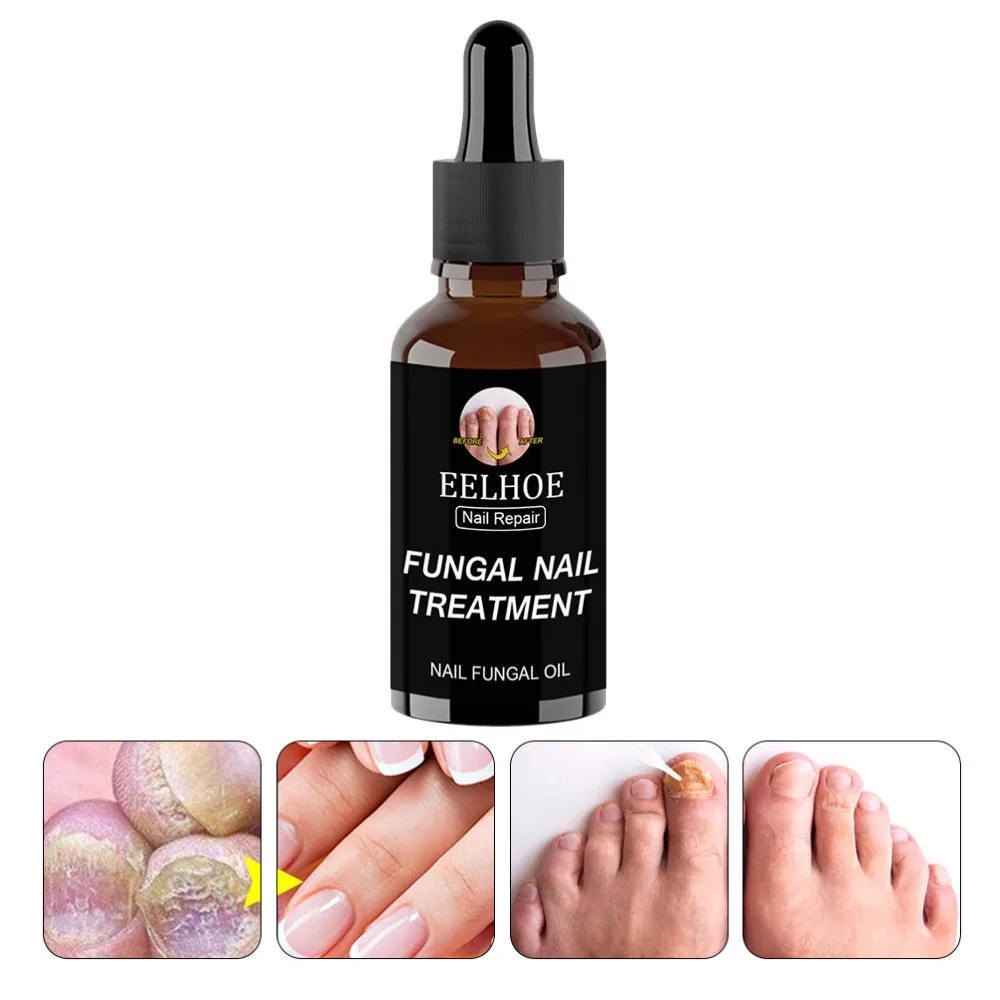 

2pcs Nail Fungus Remover Toenail Fungus Treatment Nail Treatment Liquid