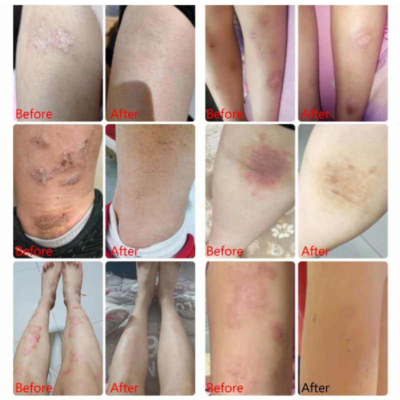 

Body Skin Care Health