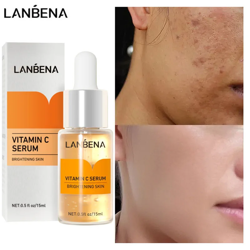 

LANBENA Vitamin C Whitening Face Serum Lighten Spots Fade Dark Skin Essence Brightening Facial Spots Remove Freckle Speckle Car