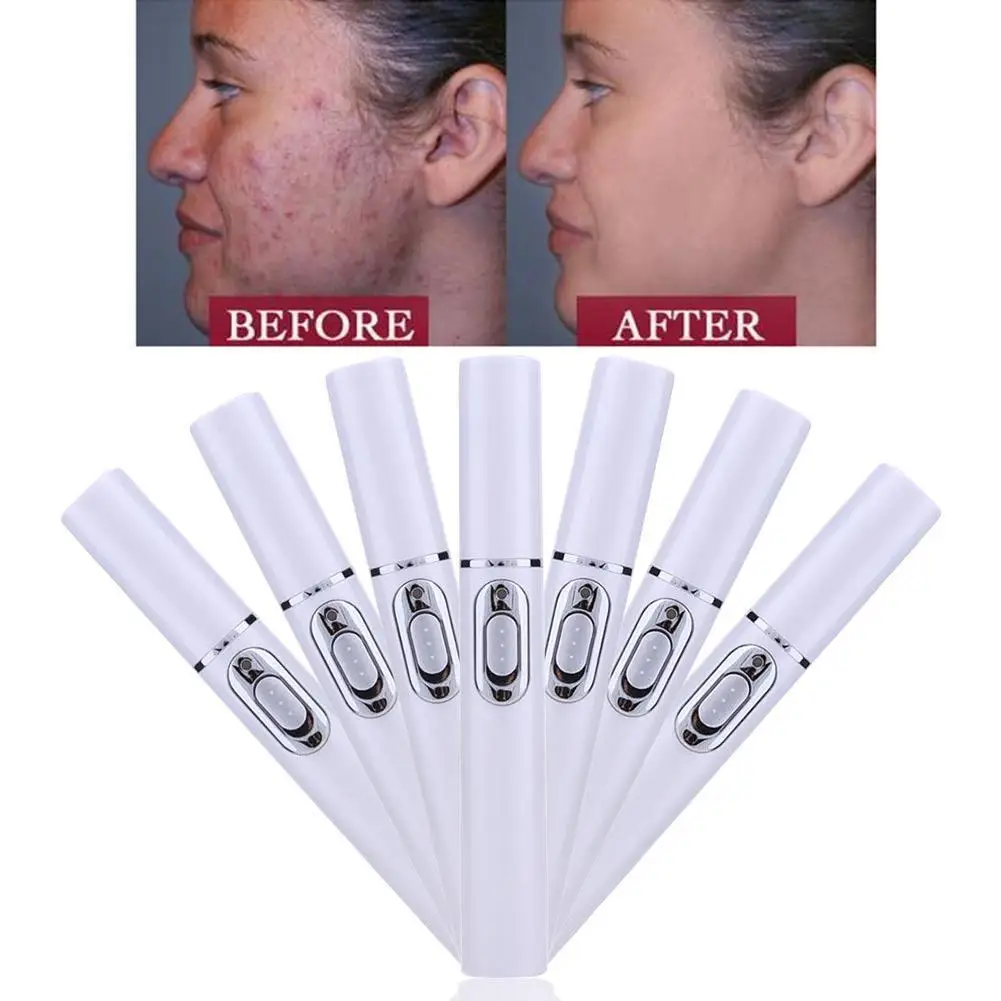 Угревой сыпи ручка Портативный машина прочный удаление шрам рекламная массажной