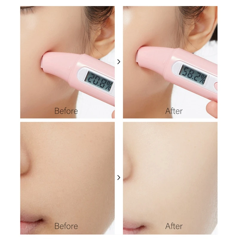 VENZEN Nicotinamide крем для лица против старения удаление морщин Укрепляющая подтяжка