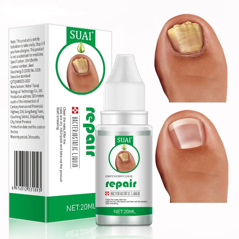 

10PCS Nail Fungus Treatment Feet Care Essence Foot Whitening Toe Nail Fungal Removal Gel Anti Infection Paronychia Onychomycosis