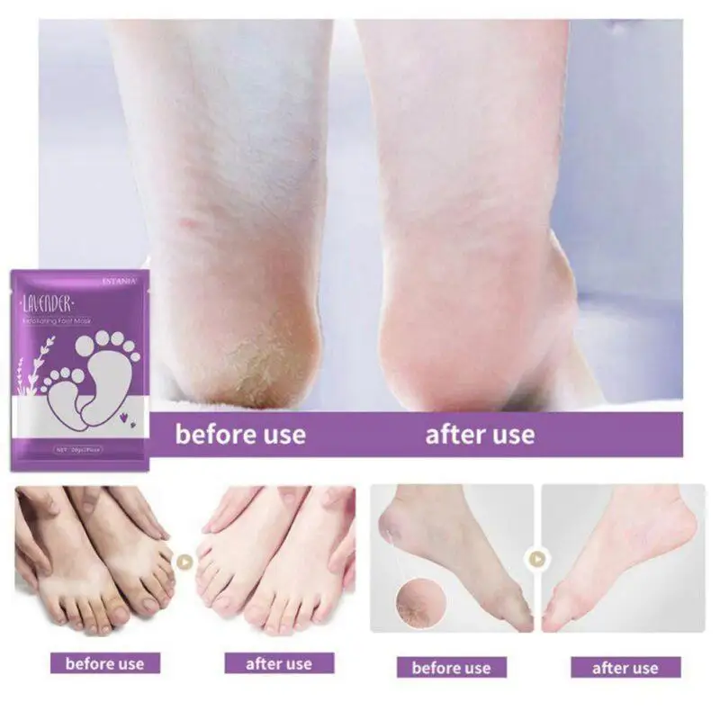 

Recommend 2Pcs Remove Dead Skin Foot Masks Exfoliating Renewal Pedicure Remove Dead Skin Heel Socks
