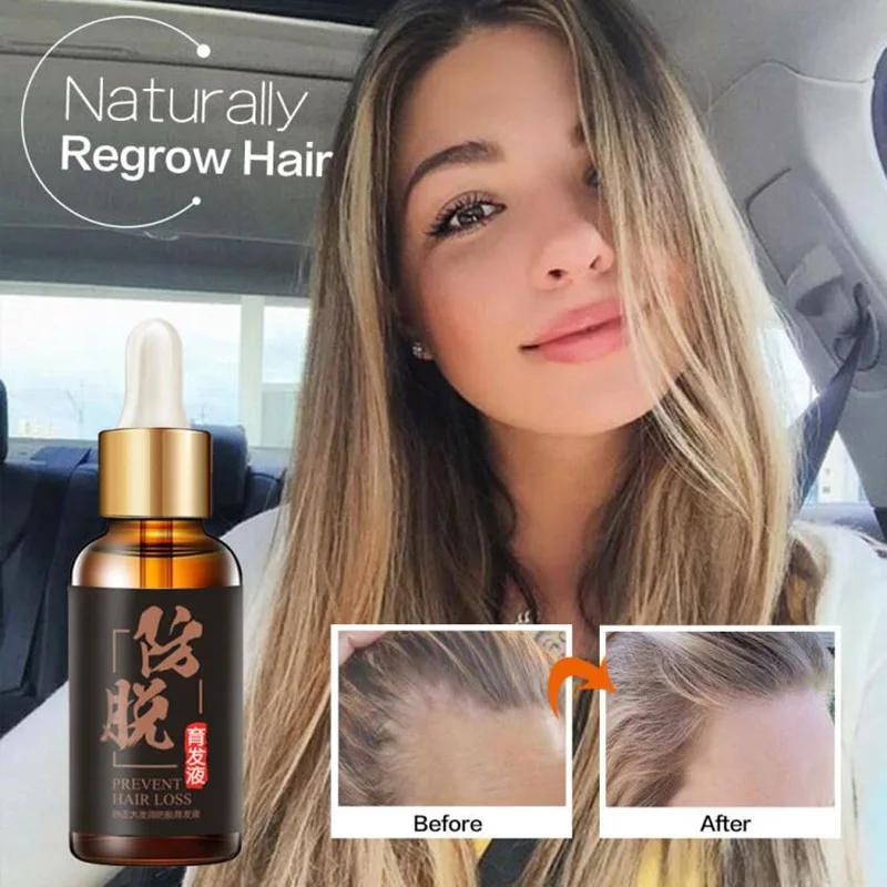 3 шт. масло для роста волос против выпадения бороды восстанавливает поврежденные