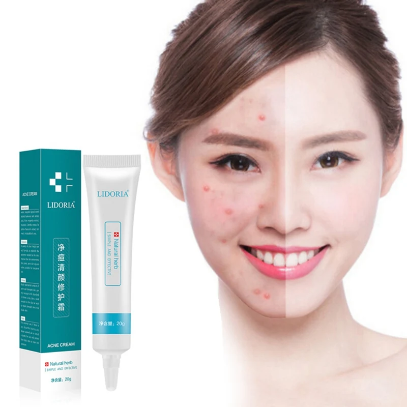 Acne Treatment Hyaluronic Acid Face Cream Acne Scar Remove Skin Care Shrink Pores Blemish Facial Spot Cream