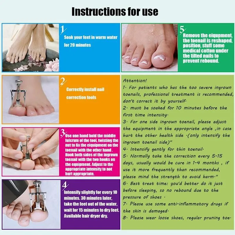 Steel Nail Art Correction Tool Of Foot Toe Nails Meat Claws Ingrown Orthosis Pedicure Tools Feet Corrector Health Care | Красота и