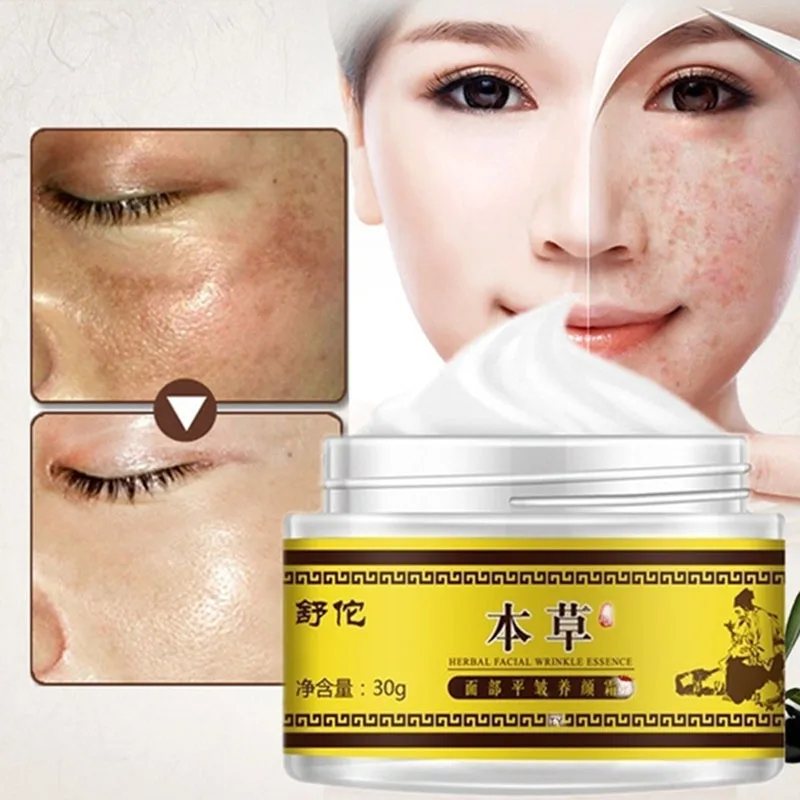 

Efficient Skin Whitening Freckle Cream Chinese Herbal Face Cream Remove Dark Spots Face Brightening Anti-aging Repair Serum 30g