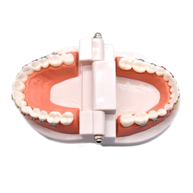 Модель стоматологической ортодонтической терапии с Орто-металлическим