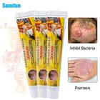 3 шт., мазь Sumifun с тигровым бальзамом для ухода за кожей, лечение экземы псориаз, дерматит, китайский травяной Антибактериальный крем против грибка