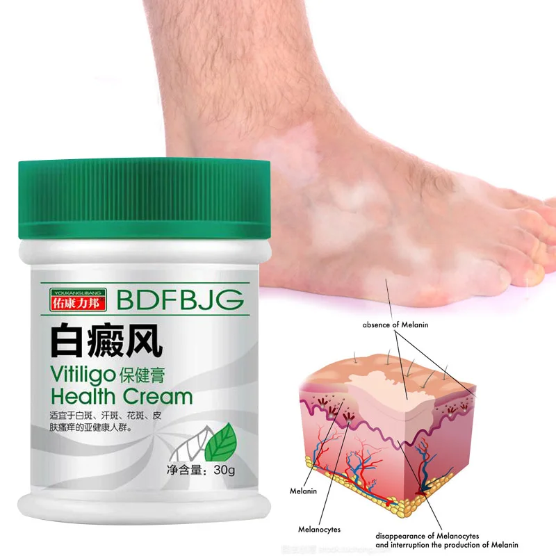 

White Spot VitiligoTreament Cream Antibacterial Cream Localized Vitiligo Ointment Mycosis Leukoplakia Treatment