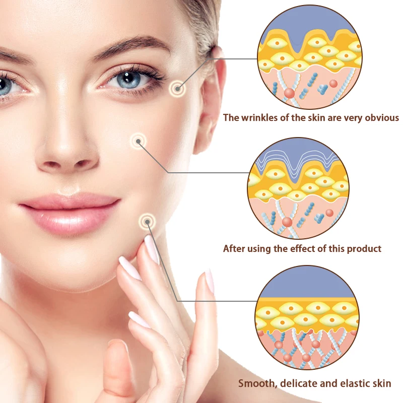 Tea Tree Snail Essence Face Cream Anti-aging Moisturizer Nourishing Collagen Women Skin Care Hyaluronic Acid | Красота и здоровье