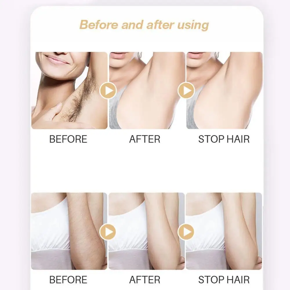 Длительное торможение роста волос Новый ингибитор спрей для стоп лица ноги тела