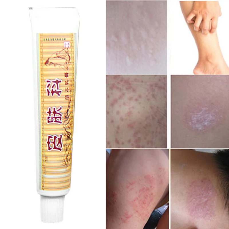 

Psoriasis Cream Relieve Skin itching for Dermatitis and Eczema Pruritus Psoriasis Ointment Herbal Creams M2
