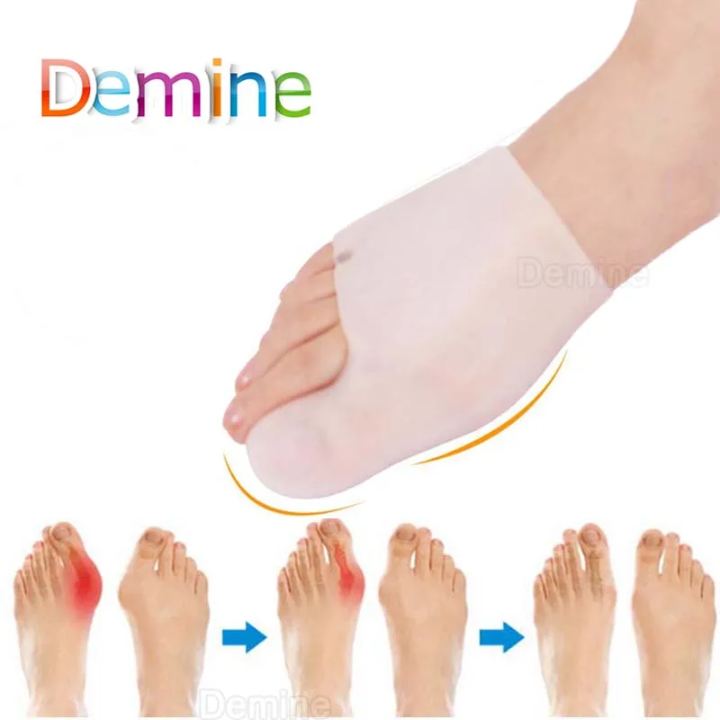 Набор силиконовых передних ножек для больших костей ортопедический корректор