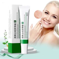 whitening cream for acne and acne treatment to reduce acne spots control oil shrink pores and moisturize acne skin care