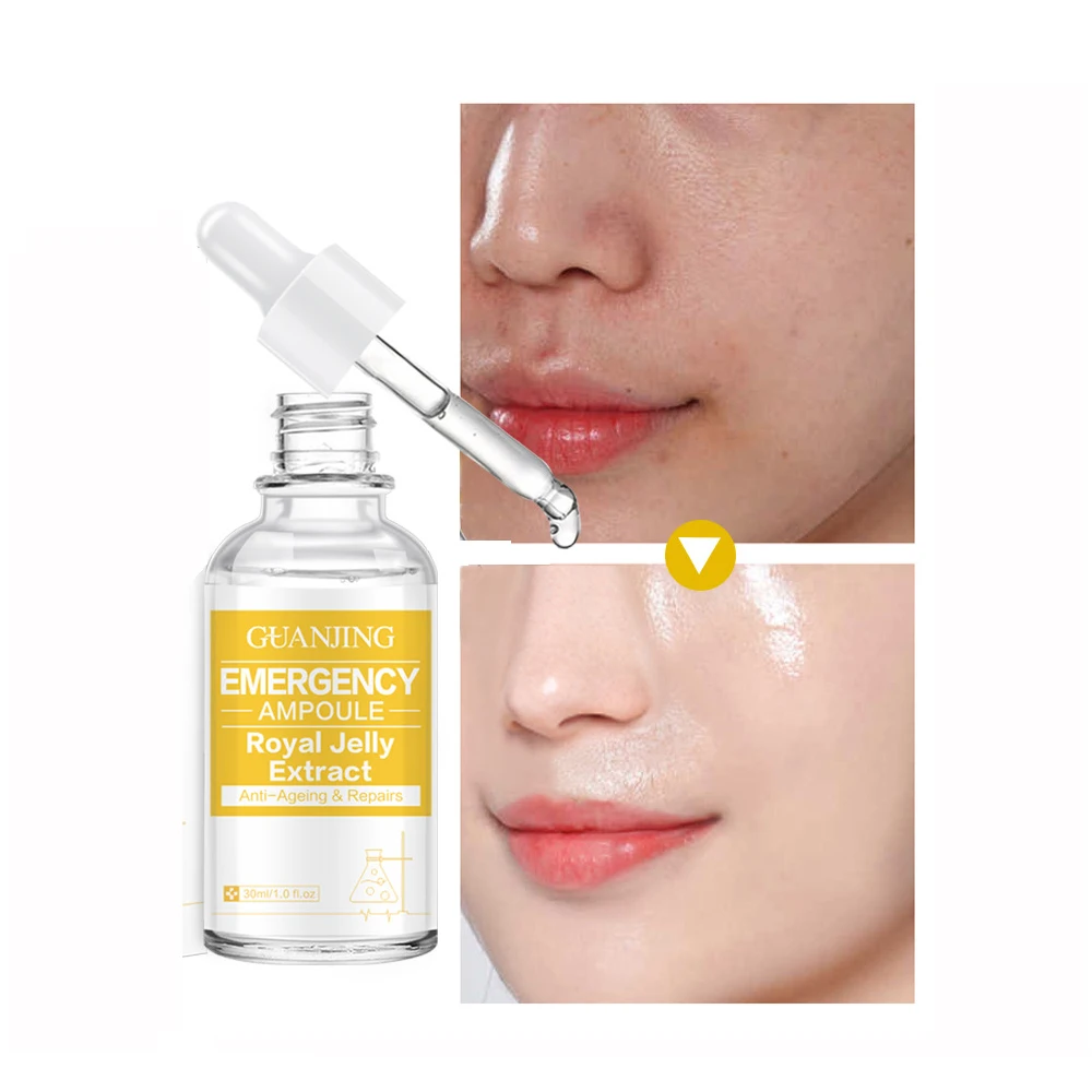 

Экстракт маточного молочка, ампульная эссенция, подтягивающий лифтинг лица Сыворотка, восстановление поврежденной кожи, увядание тонких л...