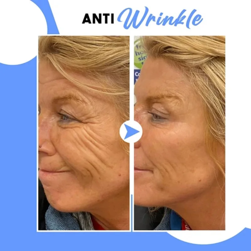 Оптовая продажа 90 шт/бутылка витамин е экстракт капсулы против морщин