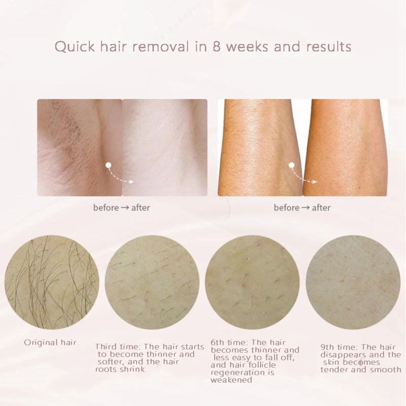 

Electric Hair Removal Apparatus Replaceable Lamp Head Apparatus Zero Pain Permanent Hair Removal EU Plug