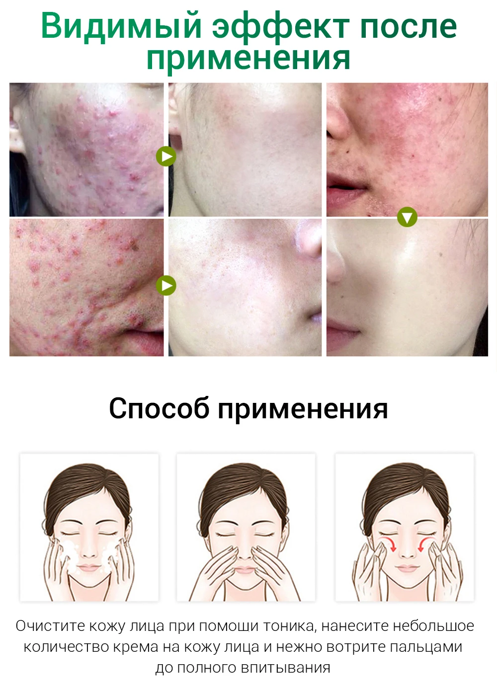 Breylee маска для лица крем для лица сыворотка для лица от прыщей лечение акне Сыворотка для ухода за кожей лица Маска Крем против акне крем отбеливающий крем маски для лица устройство для удаления прыщей инструменты