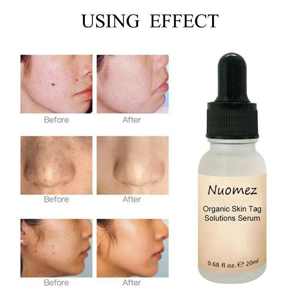 

20ml Organic Skin Spot Purifying Serum Natural Free Odorless Painless Removal Care Skin Cream Tag Repair Freckle Mole