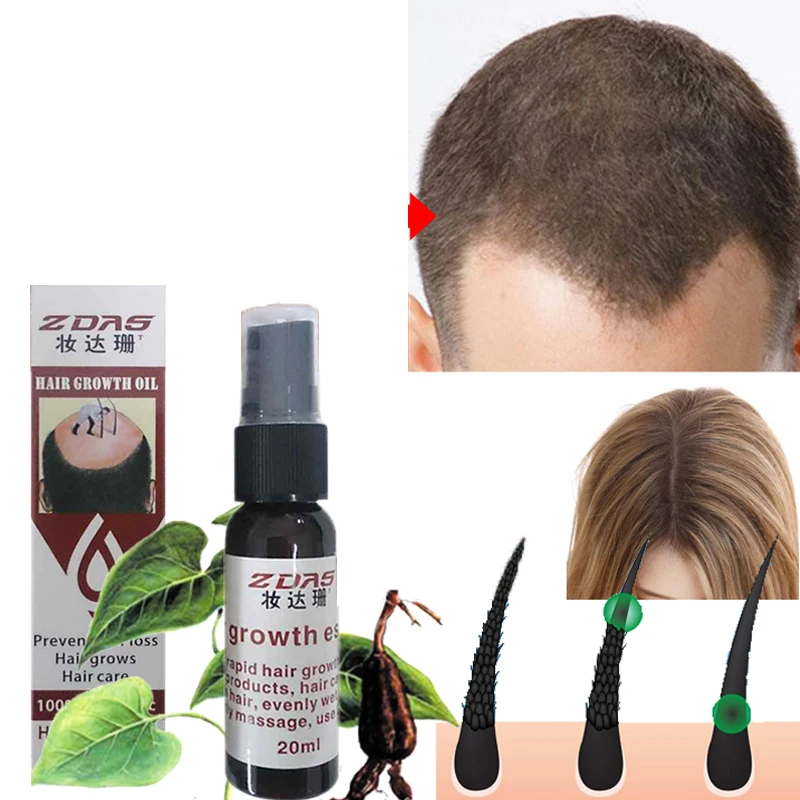 

Эффективная эссенция для роста волос, масло, филировка, продукты против выпадения волос, восстановление волос, против выпадения, уход за вол...