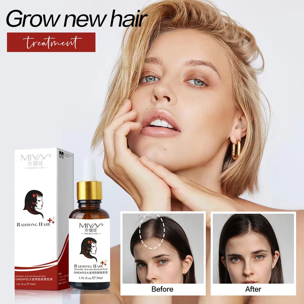 Быстрое наращивание волос эссенция масло против алопеции лечение помогает