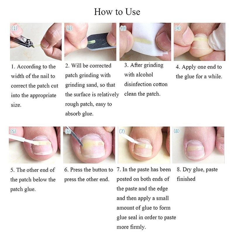 Вросший инструмент для педикюра на носках 10 шт./зажим выпрямления бутылок