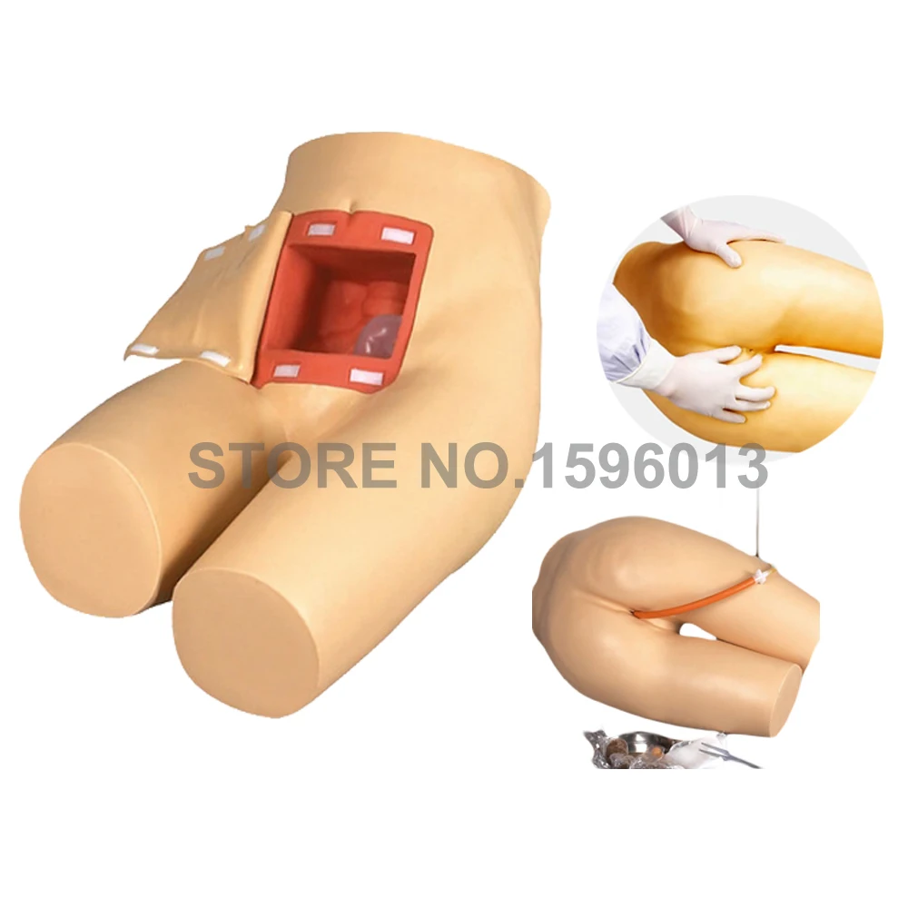 Усовершенствованная клизма и вспомогательный симулятор обучения при дефиците |