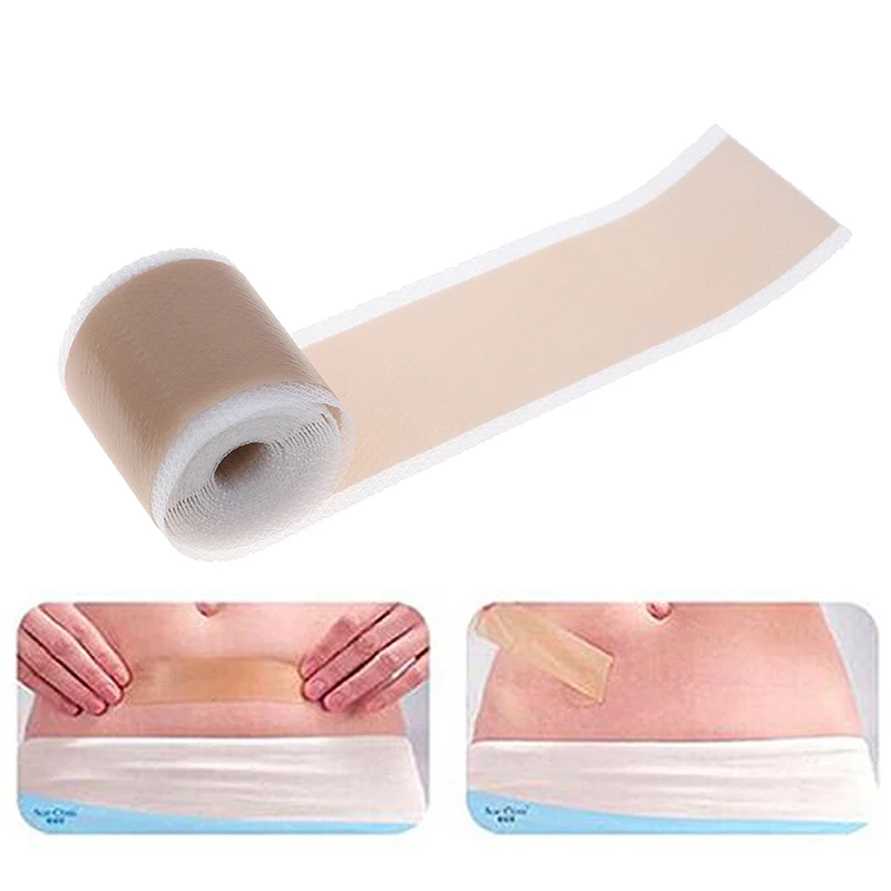 Efficient Surgery Scar Removal Silicone Gel Sheet Therapy Patch for Acne Trauma Burn Skin Repair Treatment 4x150cm |