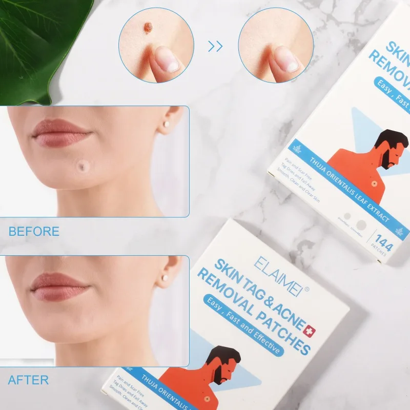 

144Pcs/Box Removal Patches Wart Removal Patch Patch Stickers Acne Skin Care Y1