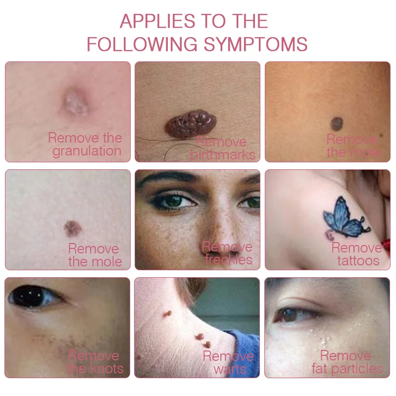 Лазерная плазменная ручка для удаления бородавок на коже инструмент татуировок