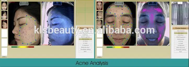 

Best Professional Skin Analysis Machine / Facial Skin Analyzer with good quality