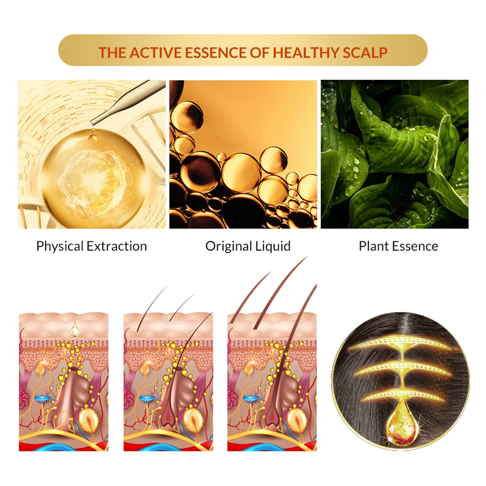 Спрей для роста волос против выпадения эфирное масло жидкий Уход за волосами