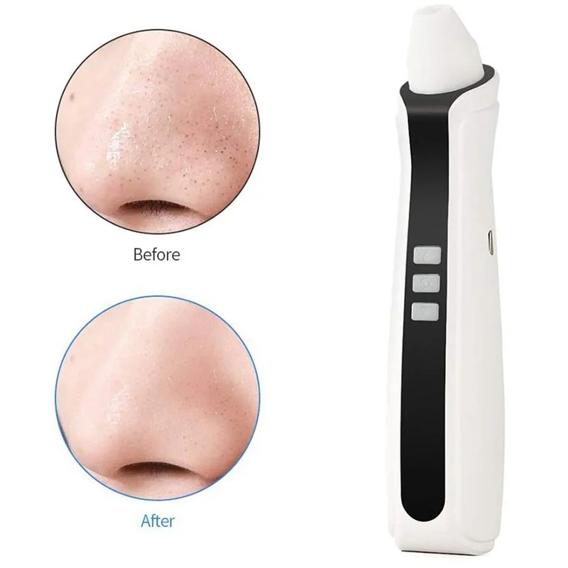 Визуальный Инструмент для удаления чёрных точек USB Перезаряжаемые поры лица