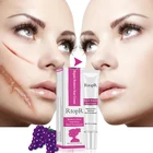 Крем Для Удаления растяжек от акне и шрамов, уход за кожей