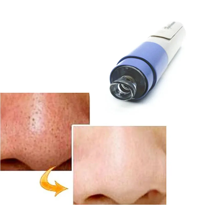 Лицевой лоб нос пористая кожа очищающий массажный очиститель для лица угрей Zit