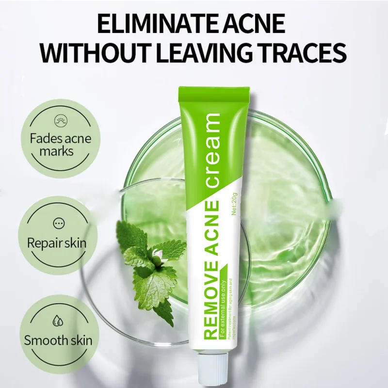 

Oil Control Acne Treatment Fade Acne Spot Face Care Shrink Pores Whitening Moisturizing Acne Cream Effective Acne Removal Cream