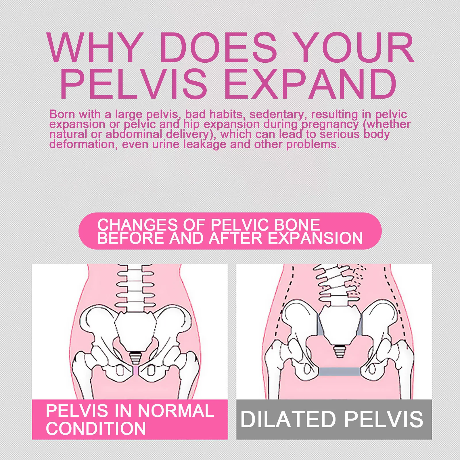

Pelvic Correction Inflatable Belt Postpartum Recovery Band Hip Lifting Postpartum Muscle Repairing Belts Corrector Braces #3G