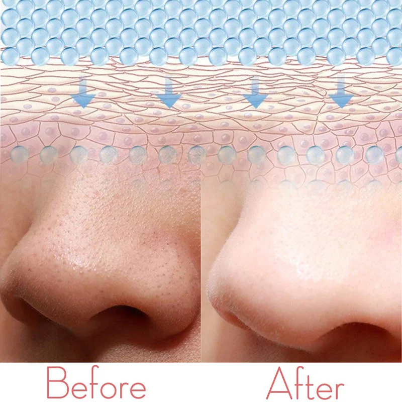 Скребок для скруббера угрей кожи и устройство нежной кожуры-очищающее средство