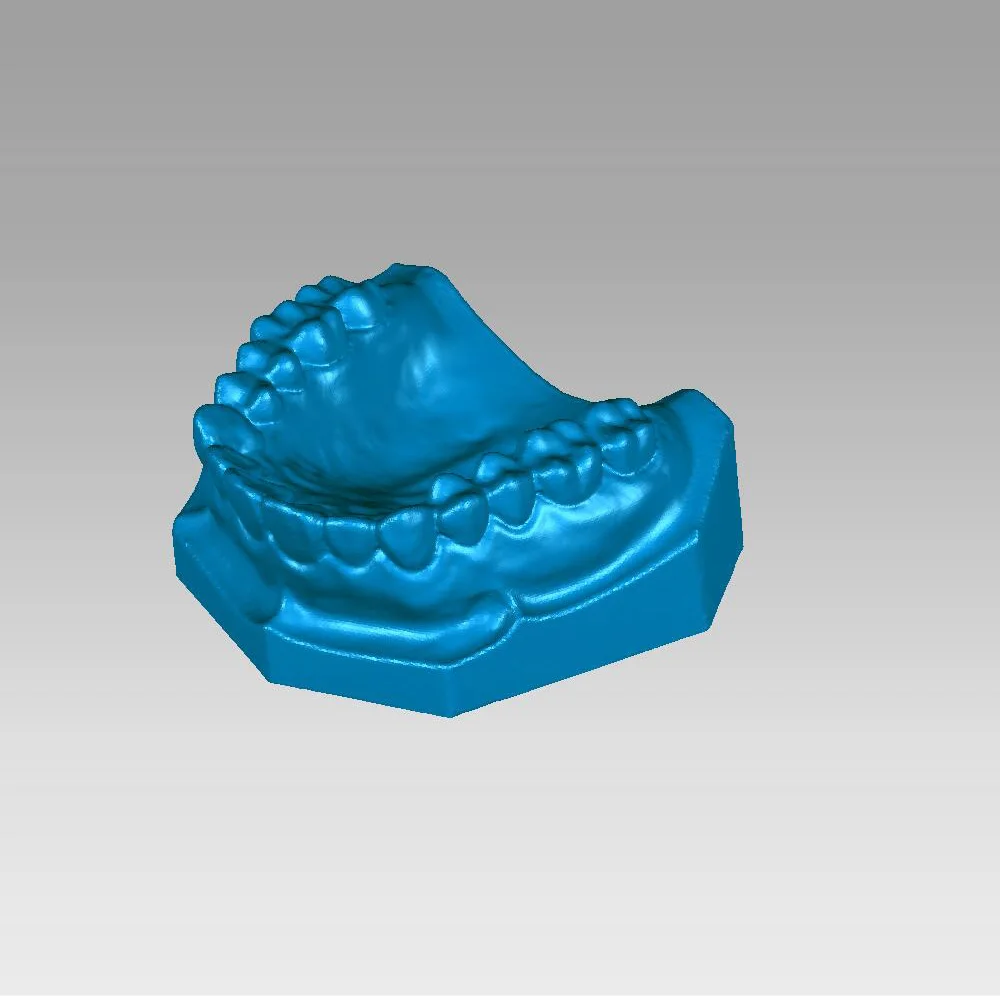 KS 3d Scanner 3D Photogrammetry DIY Kit scanning Dental teeth model . |