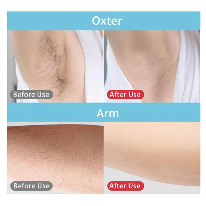

999999 Professional Permanent IPL Epilator Hair Removal Electric Photo Painless Hair Removal Machine