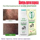 Травяной женьшень Zudaifu, Кератиновый Уход за волосами для мужчин и женщин, мощный Уход за волосами, сыворотка для роста, восстанавливающие шампуни 120 мл