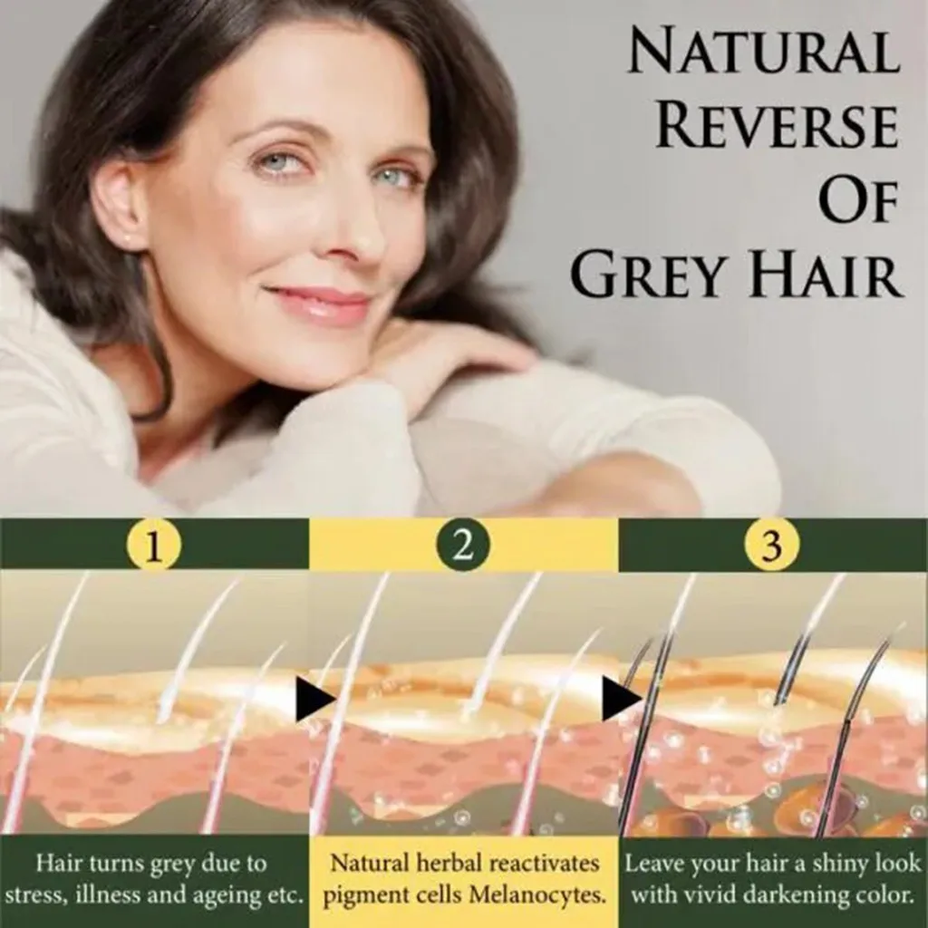 Natural Darkening Shampoo Anti-Dandruff For Anti Hair Loss Moisturizing Black Ginger Coloring | Красота и здоровье