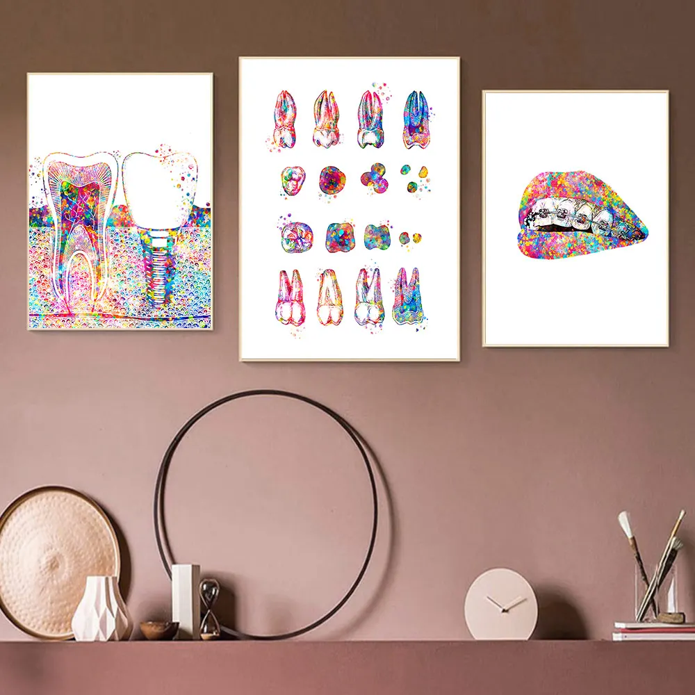 

Tooth Implant Wall Art Canvas Painting Posters Prints Dental Dentist Anatomy Medical Wall Pictures Hospital Clinic Home