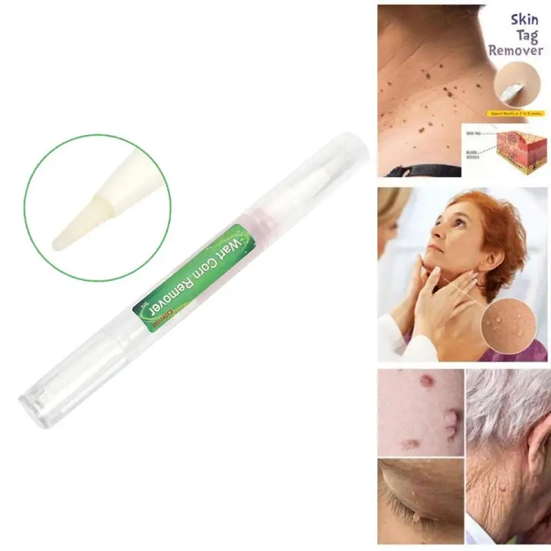 Бородавка для кожи средство удаления кукурузы ног ручка лечения естественного