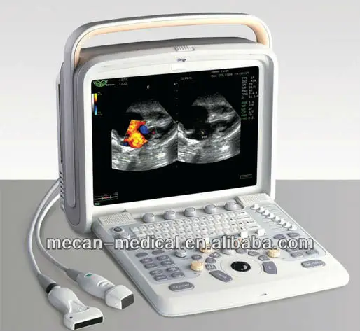 

sun-906w Compact & Reliable Portable Cardiac Vascular Doppler Ultrasound Blood Flow