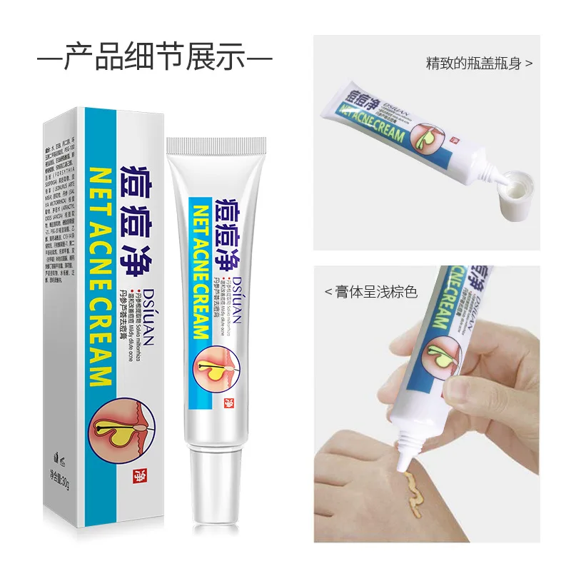 

Refine Pores Mild Purifying Acne Cream Moisturizing For Facial Care Hydrating Brighten Skin Colour Balance Water And Oil