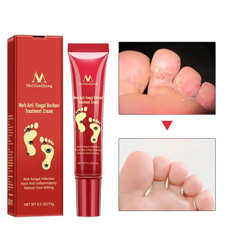 

Foot Care Cream Anti-fungal Infection Foot Anti-inflammatory And Relieving Foot Itching Treatment Cream