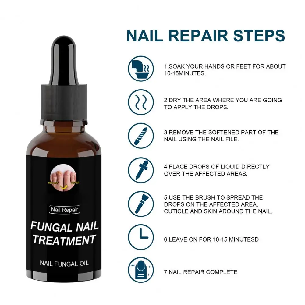 

10ml/20ml/30ml/50ml Nail Fungal Oil Anti Infection Moisturizing Synthetic Gentle Nail Repair Essence for Onychomycosis Repair